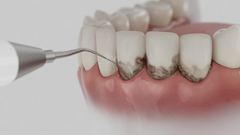 Reliable Dental contractor in Ross, OH by Smile Center Dentistry